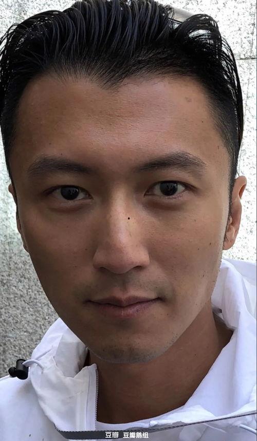 有头皮屑的明星,揭秘有头皮屑的明星如何闪耀舞台