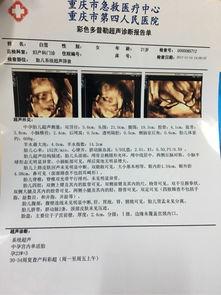 明星养成系统b超